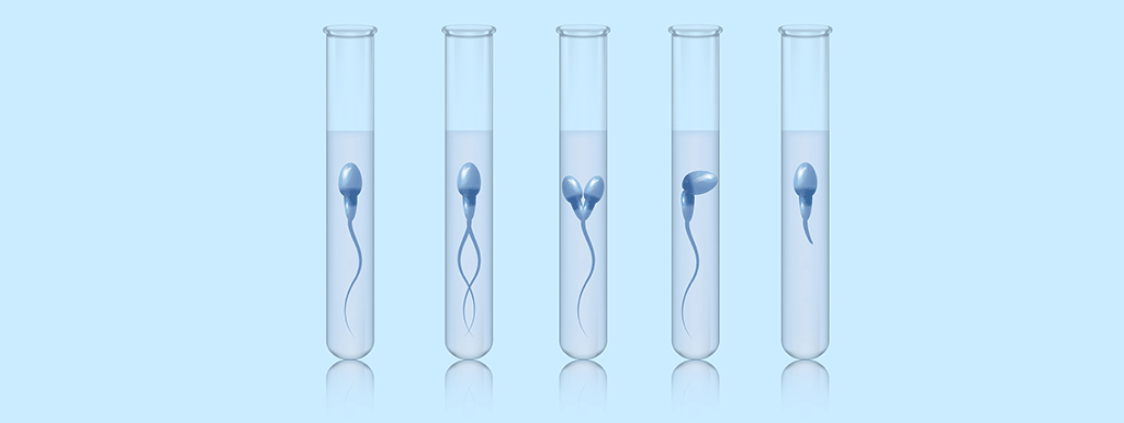 Zink en foliumzuur en DNA-methylatie