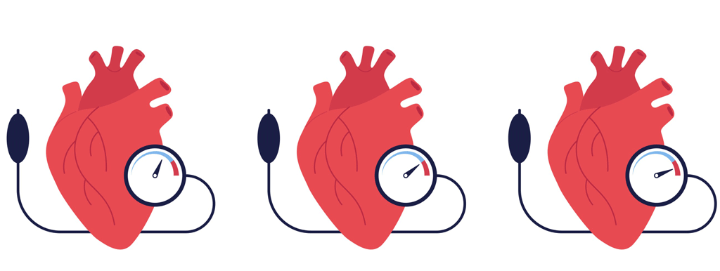 Vitamine D en bloeddruk obesitas