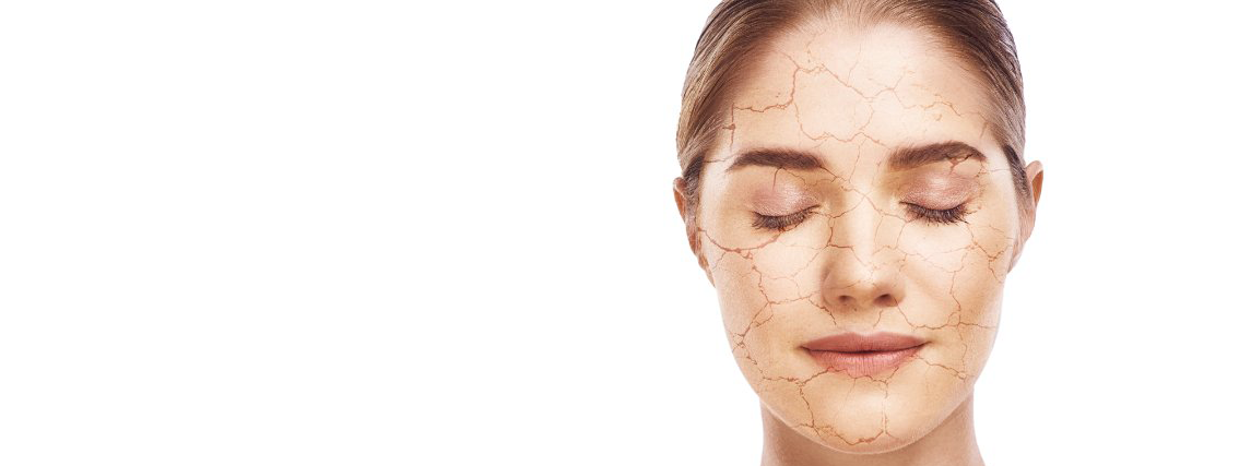 Collageen, ceramiden, hyaluronzuur, en procyanidine hydrateren huid