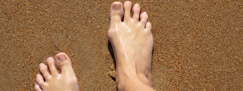 Vitamine C niet vitamine E tegen jicht