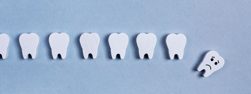 Tandverlies en diabetes versnellen mentale achteruitgang