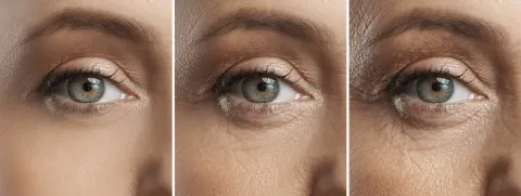 Microbioom en kraaienpootjes