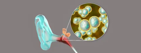 Oorontsteking natuurlijk oplossen