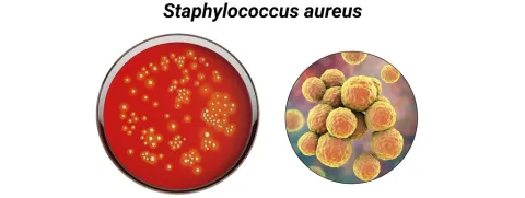 Probioticum vermindert kolonisatie Staphylococcus aureus