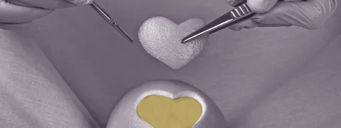 Vitamine C en thiamine voor postoperatief herstel