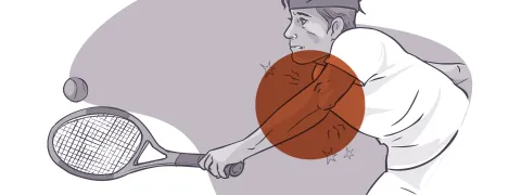 Suppletie en schokgolven bij tenniselleboog